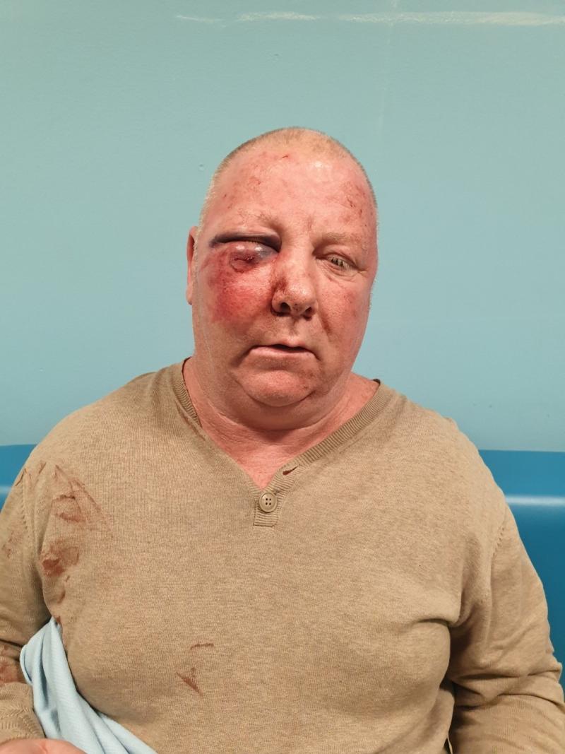 Anthony Giblin's injuries 